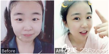 深圳兰乔医疗美容整形医院口碑怎么样 案例 医生 优惠价格 美佳网