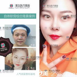 中山美尔医疗美容整形医院口碑怎么样 案例 医生 优惠价格 美佳网